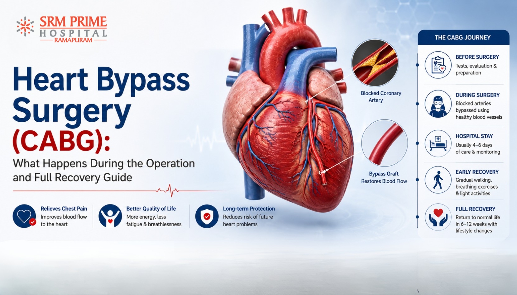 Heart Bypass Surgery (CABG): What Happens During the Operation and Full Recovery Guide